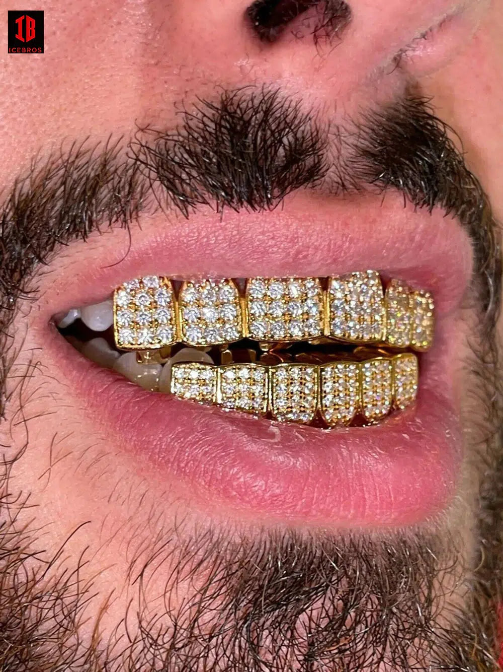 MOISSANITE GRILLZ Passes Diamond Test Teeth Top & Bottom Hip Hop 925 Silver Iced